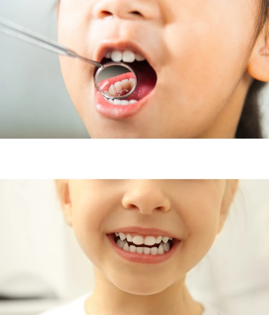 Crecimiento y desarrollo orofacial — Odontopediatría en la Clínica Dental Infantil de Toledo