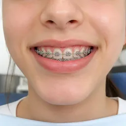 Ortodoncia para niños en la Clínica Dental Infantil de Toledo